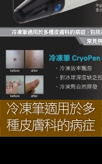 冷凍筆適用於多種皮膚科的病症